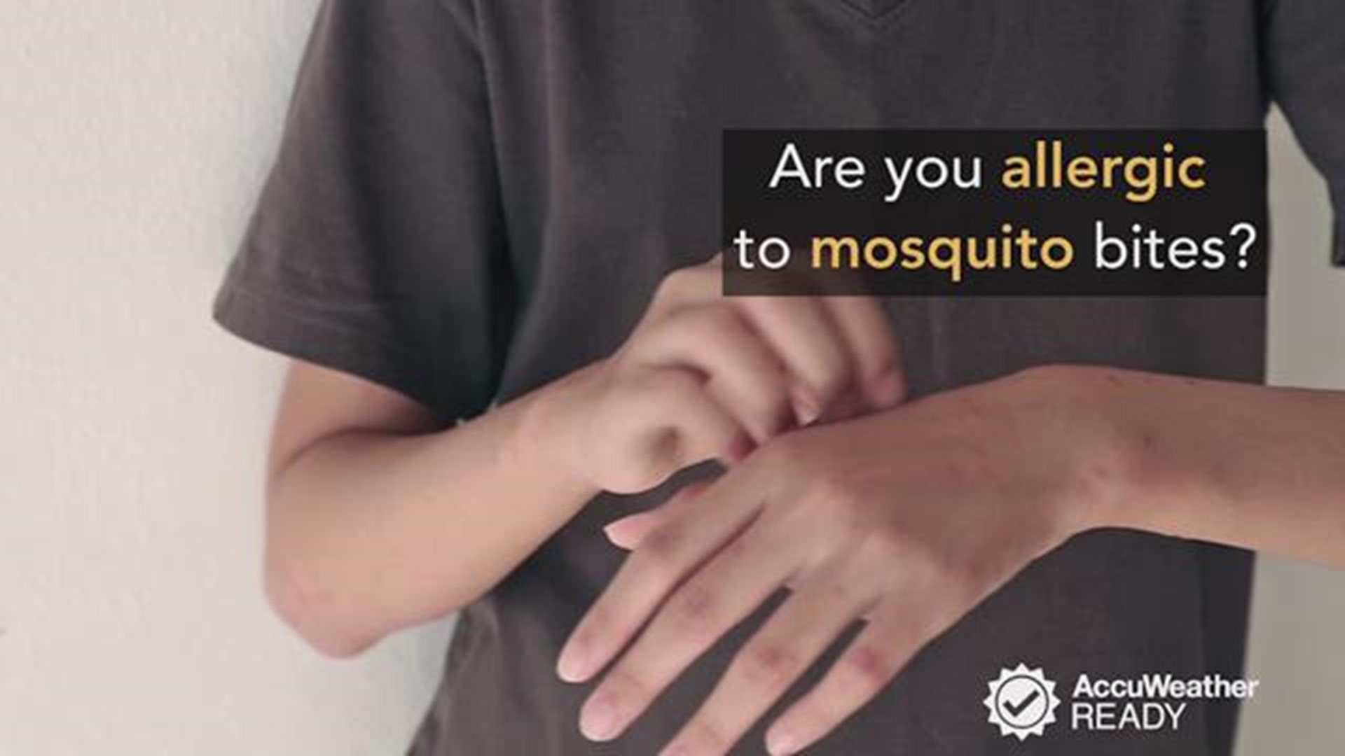 are-you-allergic-to-mosquito-bites-cbs19-tv