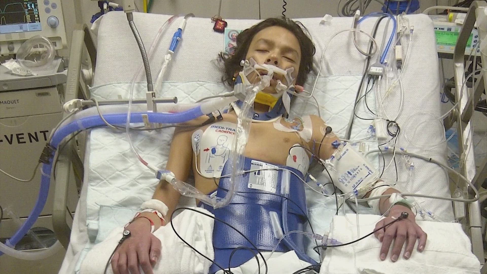 Although it's rare, doctors at UT Physicians want parents and teachers to know when a student-athlete has a sudden cardiac arrest.