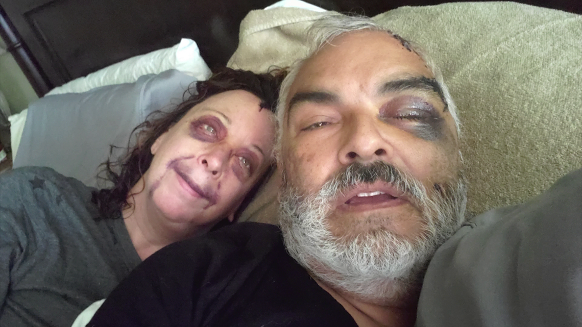Pearland couple attacked by hammer-wielding burglar - Vimarsana News