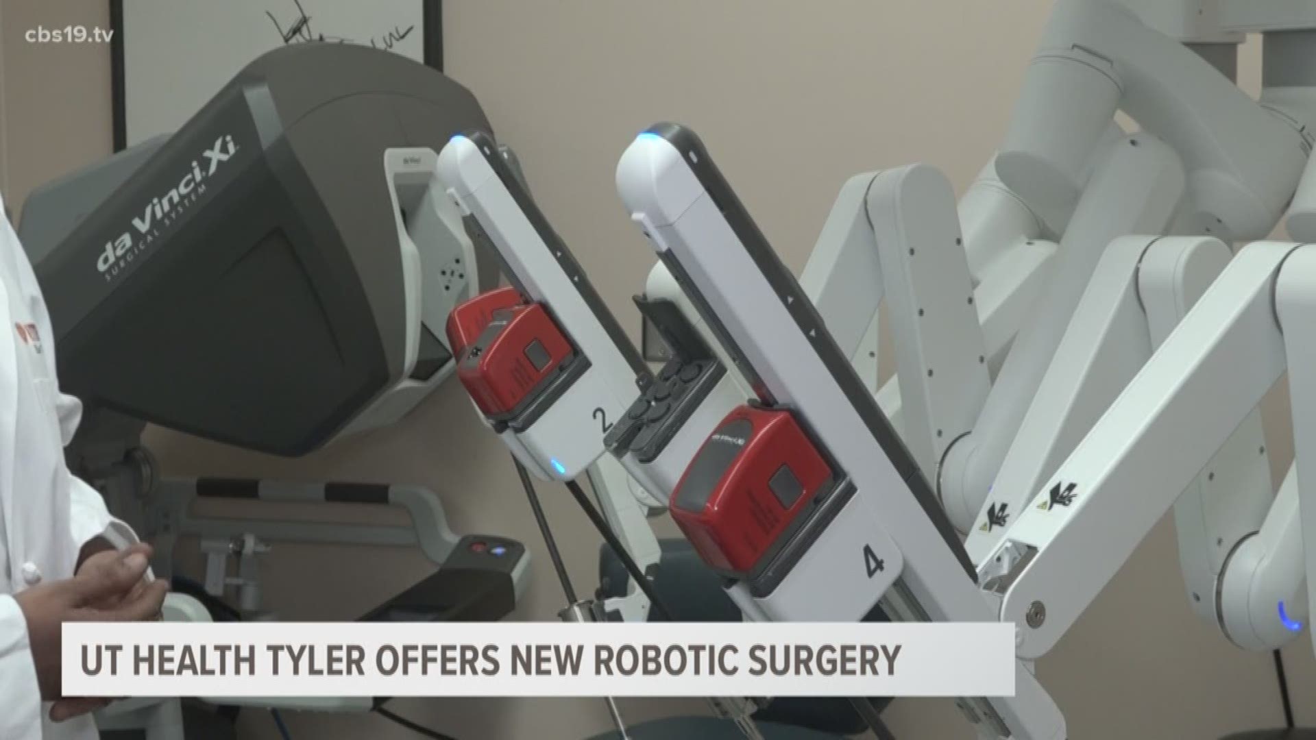 UT Health East Texas is upgrading its surgery techniques, benefiting both surgeons and patients. This robotic system made its debut last week. its similar to what the hospital already had but the difference is it's an upgraded model.