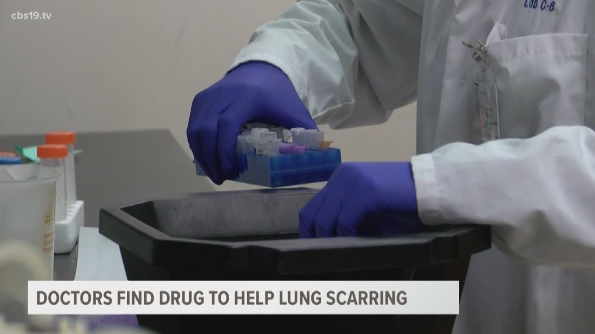 Two doctors with UT Health Science Center have discovered a drug to not only prevent lung scarring, but also reverse it.