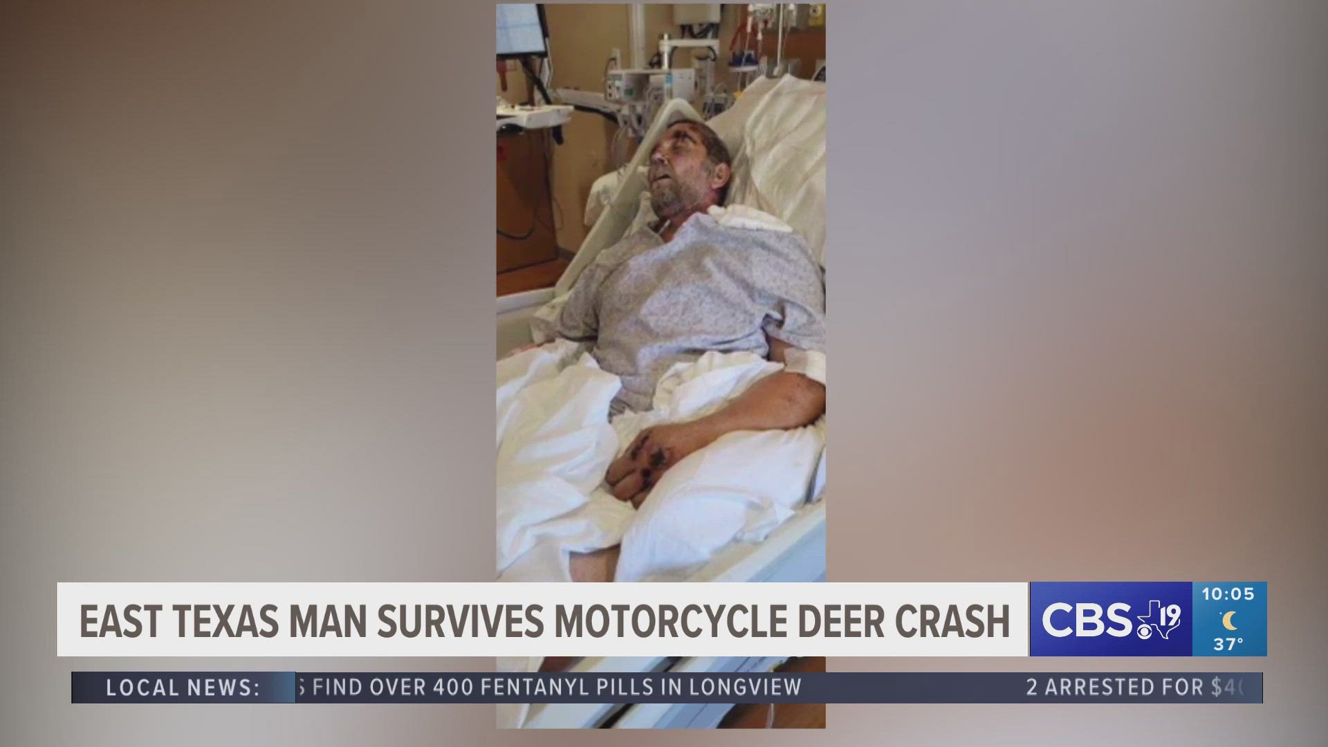 It’s been three years since George Patrick was in a motorcycle crash that changed his life forever.