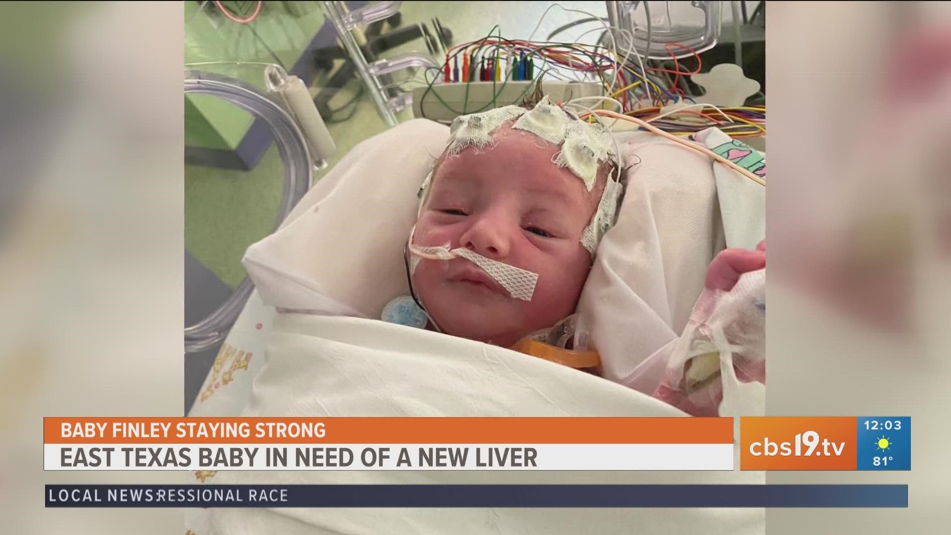 Texas baby in desperate need of liver donor