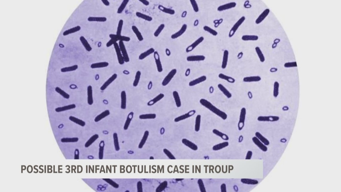 what is environmental infant botulism