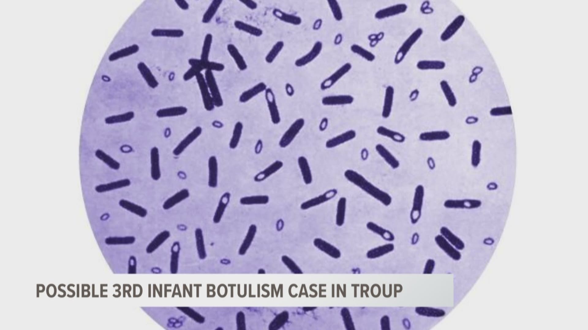 Doctors Searching For Source Of Toxin Causing Infant Botulism In East ...