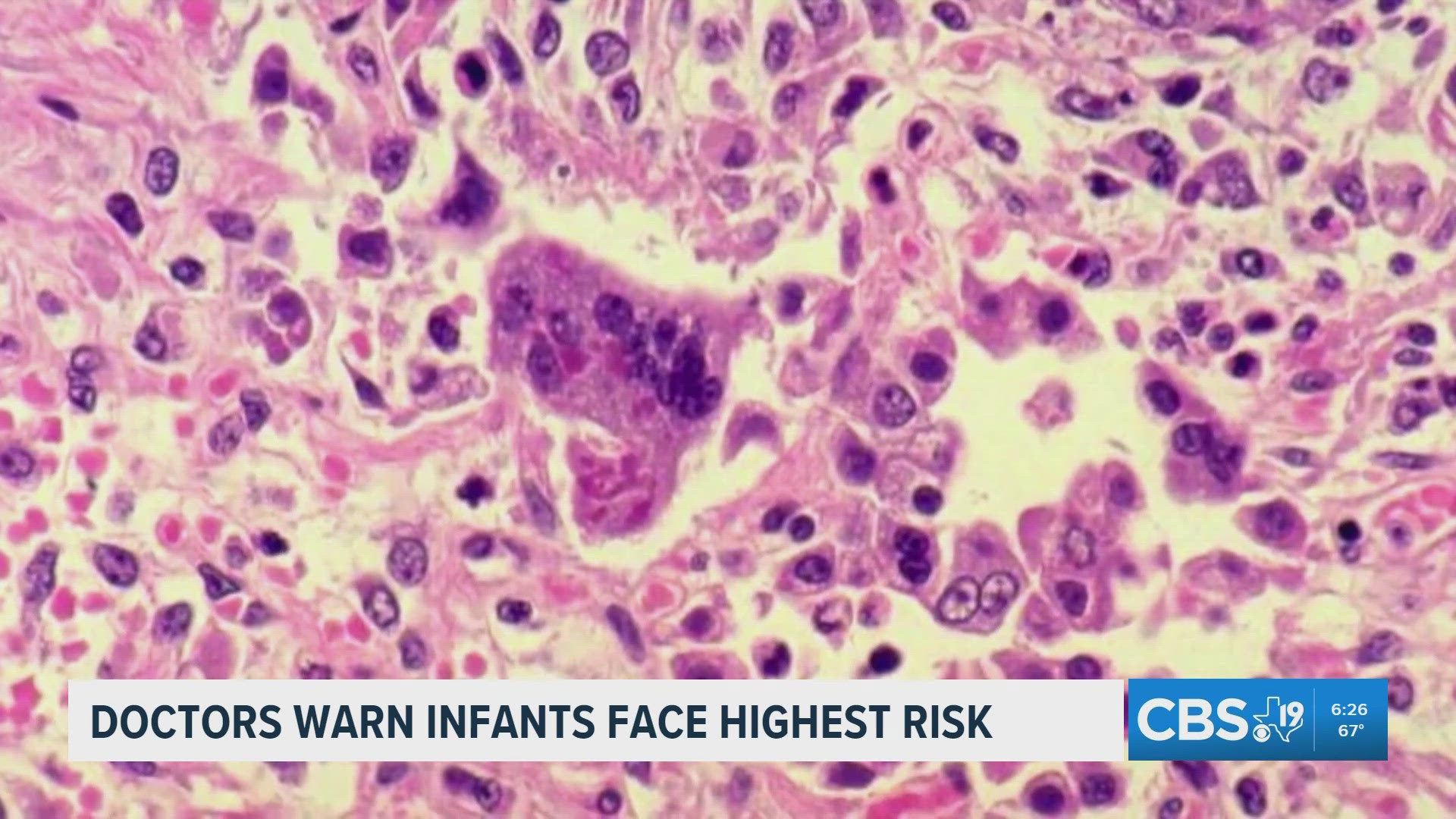 President Trump and Iran's foreign minister say the Strait of Hormuz is ...